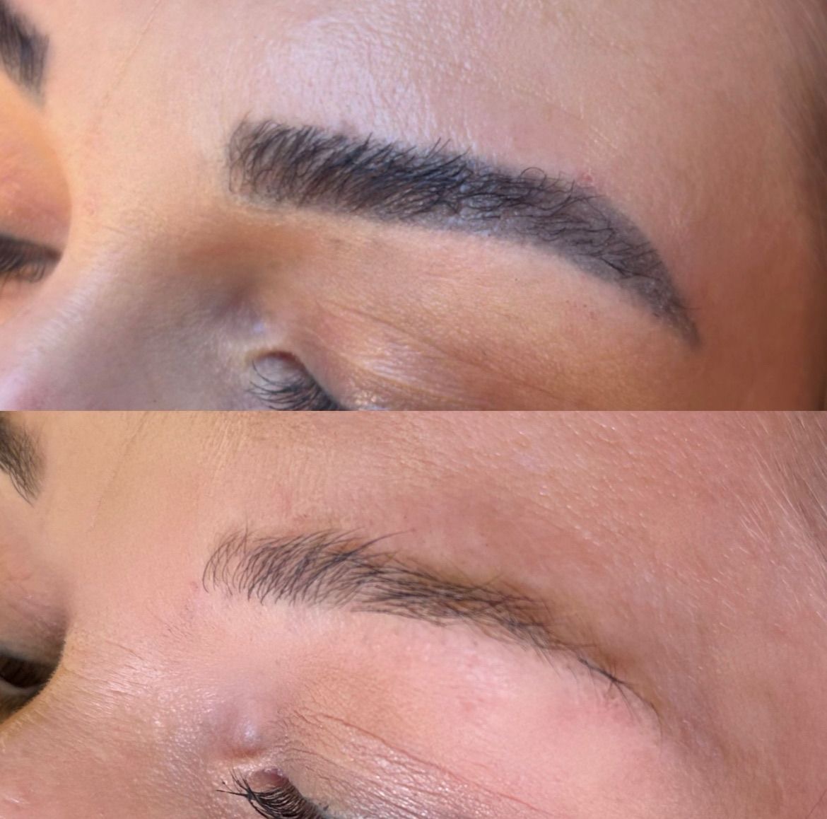 Permanente make-up verwijderen met laser